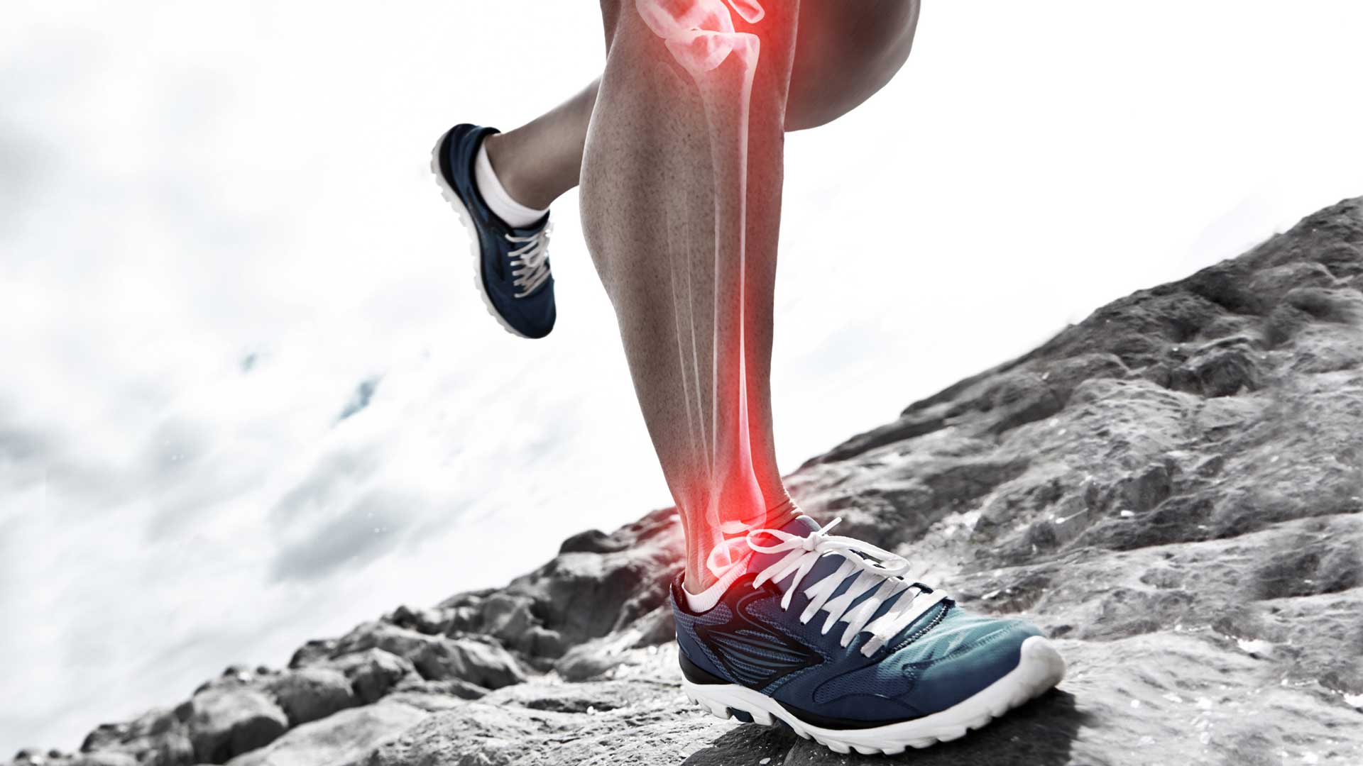 Las lesiones no son infrecuentes en el trail running. (Foto: iStock)